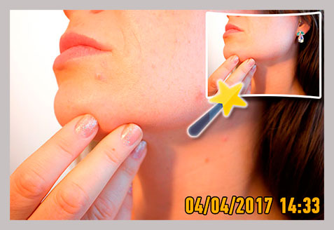 Photo Stamp Remover لقطة